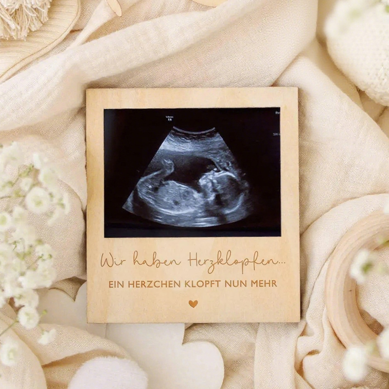 Ultrason Gebelik Duyuru Levhas - Photo Booth Frame incelemesi ve fiyatı