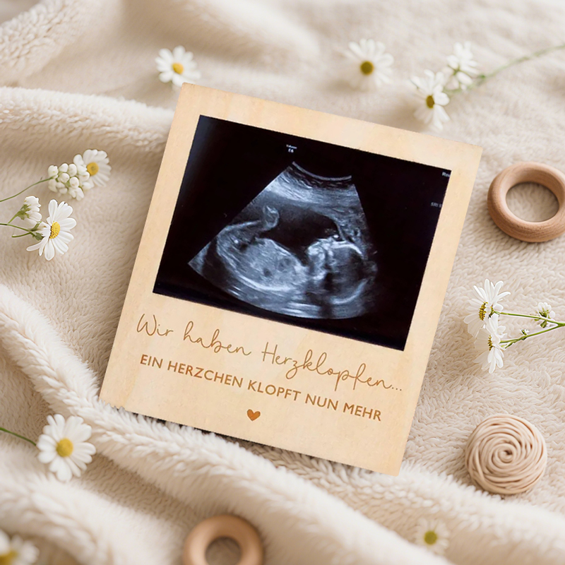 Ultrason Gebelik Duyuru Levhas - Photo Booth Frame incelemesi ve fiyatı
